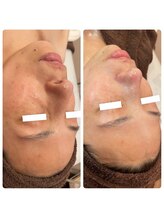 ラディエンス 多治見店/マーメイドセルトリートメント