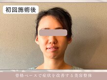 ほぐし屋 かすがい/初回/小顔リフト＋美姿勢整体
