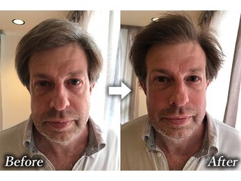 トランザット 六本木店(TransATT)/顎ラインが整い、目元が引き立つ