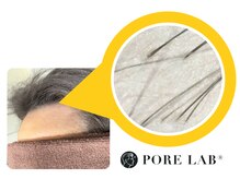 ポア ラボ(Pore Lab)/高知 育毛促進 スカルプケア