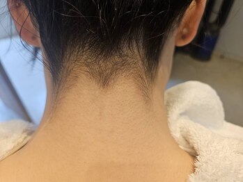サロン ド ラマン メジロ(Salon de Lamain .mejiro)/うなじシェービング