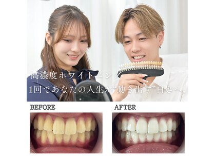 ホワイトニングショップ 四条店の写真
