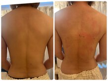 サロンドデュイ/1回施術/50 代/トーンヌール