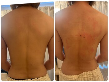 サロンドデュイ/1回施術/50 代/トーンヌール