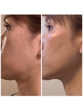 スプレール 水戸店/韓国美容クリニックで大人気！