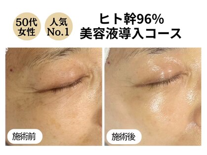 ディレイア ザ コスメ 有楽町マルイ店(direia the cosme)の写真