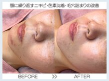 フェアリー(fairy)/