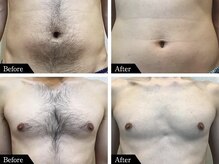 ハル(HAL)の雰囲気(結果が違う★お腹周り脱毛/胸毛脱毛《痛みの少ない国産脱毛機》)