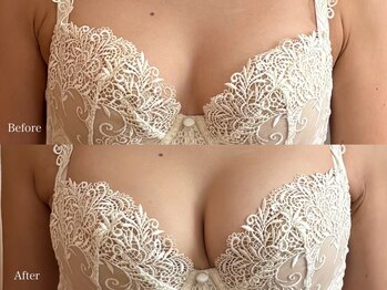 育乳整体&バストアップ専門店 Laurino salon【バストアップ/整体/姿勢改善/産後】/誰でもふっくらバストに♪