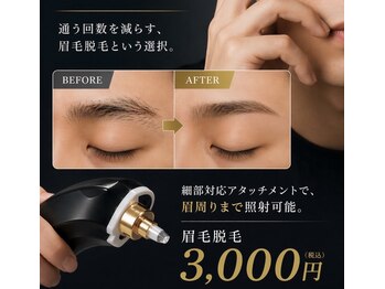 ファスモ(FASMO)の写真/県内メンズに選ばれ続ける脱毛専門店！都度払いで気軽に通えるのが嬉しい◎