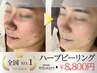 【全国1位】ハーブピーリング〈毛穴レスツヤ肌〉15000円→8800円