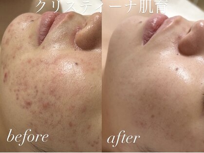 シーラックス(Sealax)の写真