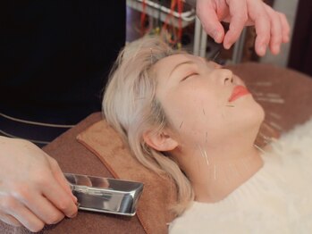 三国ヶ丘鍼灸整骨院/三国ケ丘産後整体/美容鍼灸