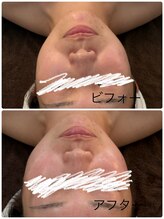 メディカルエステ ユウ(Yuu)/