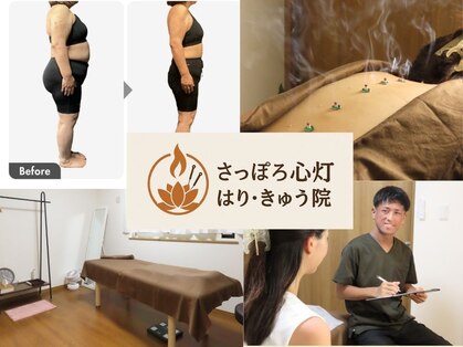 さっぽろ心灯はり きゅう院/ハリスリム 札幌山鼻(Hari-Slim)の写真