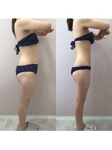 ルシアル 新宿代々木店(LUCIAL)/痩身オーダーメイド