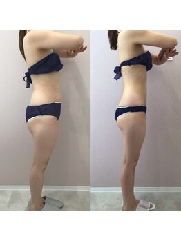 ルシアル 新宿代々木店(LUCIAL)/痩身オーダーメイド