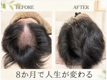 セントラル鍼灸院リラクシー(Re:laxy)
