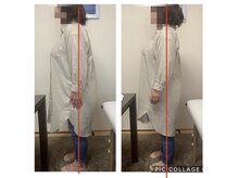 カインド整体院(KiND整体院)/足の付け根の痛みが楽になった！