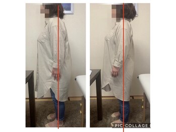 カインド整体院(KiND整体院)/足の付け根の痛みが楽になった!