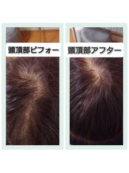 ミカエル(Mikael)/before/after