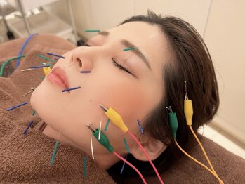 シンキュウ(SHIN9)の写真/≪電気美容鍼（30本）40分¥5500～≫美容鍼×電気でお顔の筋トレ♪エイジングケアで若々しい印象へ導きます!