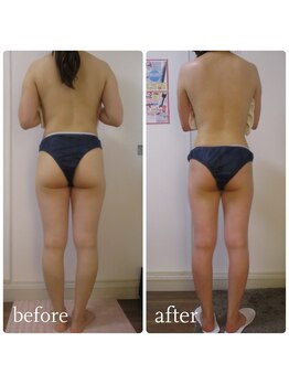 加圧ビューティーサロン スタイル エム(beauty salon style M)/20代/加圧×パワーツリー120分