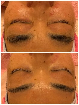 ビビアンローズ(BIBIAN ROSE)/お顔全てスッキリ