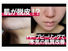 スリジエ ボーテ(cerisierBEAUTE)の雰囲気（豊富なフェイス/ボディハーブピーリング有☆悩み別Level選択可◎）