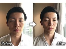 トランザット 六本木店(TransATT)/疲れ顔が一掃され、活力UP