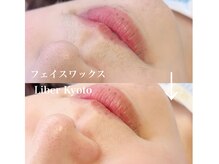 リベルキョウト 京都駅前店(Liber Kyoto)/フェイスワックス脱毛