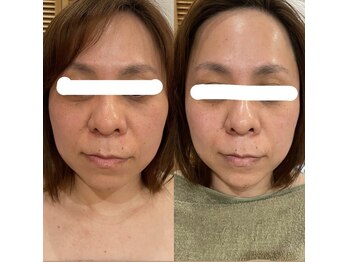 トゥーリ 春日店(tuuli)/ビフォーアフター