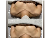 周りと差をつけるバストへ♪完全個室