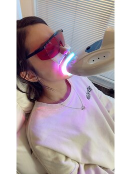 ペルラメディカルホワイトニング 名古屋/痛みにくくシミにくい