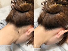 その日にキレイを実感！面倒な自己処理は不要です♪