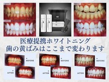 スマイルホワイト 赤羽店の雰囲気（医療提携だからセルフサロンの限界を超える白さを実現します◎）