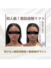 ワイズ 沖縄うるま院(Medical Y's)/別人級！小顔リフト
