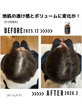 サンシー整体(SunCY整体)/５０代女性