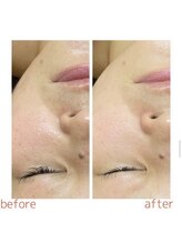 レコンテ 大通店(RECONTE)/サラブレットプラセンタケア