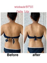 カラーリリー(Calla Lily)/肩こりのお悩み（初回）