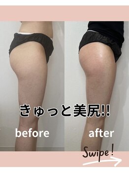 リリー(Lily)/下半身表裏1ヶ月