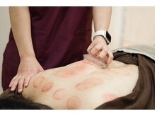 たたら鍼灸整骨院/カッピング筋膜リリース