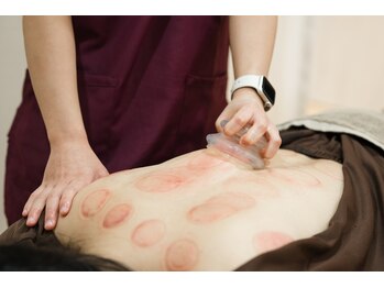 たたら鍼灸整骨院/カッピング筋膜リリース