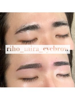 ミラ 渋谷(MIRA)/垂れ眉改善/渋谷/アイブロウ