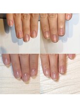キュア(Cure.)/デザインを楽しみながら自爪育成