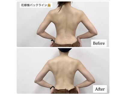 アオレニア(ao.lenia)の写真