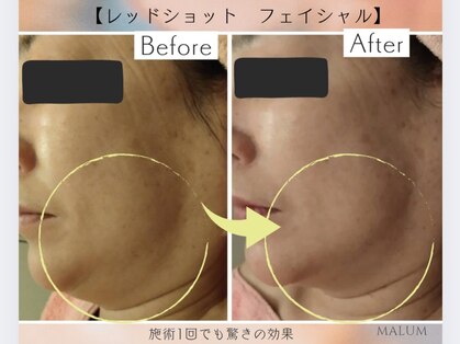 マールム(MALUM)の写真