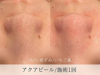 ミューズ バイ エス(MUSE BY S)/