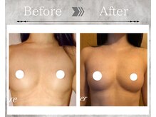 フェリス(Feliz)/【バストアップ/育乳/安城】