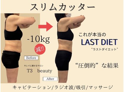 ティースリービューティー(T3beauty)の写真
